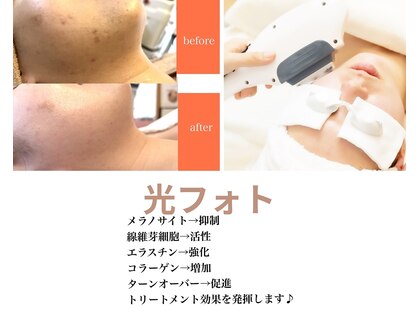 サロン ベル 八幡市(salon belle)の写真