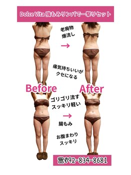 ドルチェヴィータ(DOLCE VITA)/普通のマッサージでは物足りない