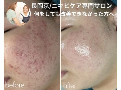 リノルーア(Linolua)の写真