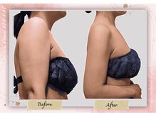 ヌーン(noon)/ブライダルエステ・痩身