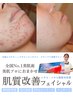 【ニキビ・跡ケア】ニキビ肌に終止符を◎"韓国肌管理"水光ピーリング肌質改善