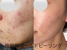 ルーク(Luke)の雰囲気（埼玉県では当サロンだけ！しみ/ニキビ/凹凸/くすみ）