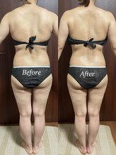 ヴィム(VIM)/ハイパーナイフビフォーアフター