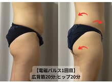 シェリール(Cherir)/電磁パルス痩身マシン