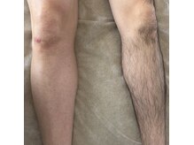 アンベリール(Embellir)の雰囲気（男の身だしなみに脱毛は当たり前！清潔感あるスベスベ肌へ◎）