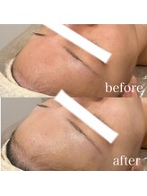 エヌ セレクション(N_selection)/くすみ撃退！