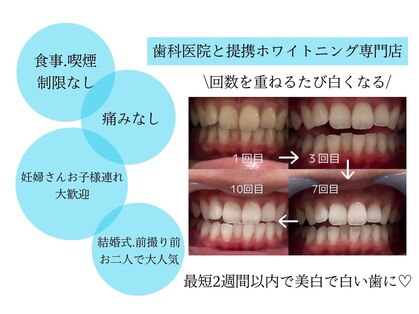 ホワイトニングショップ 刈谷店の写真