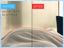 ティアワン 麻布十番(Tierone)/ヒップBefore & After