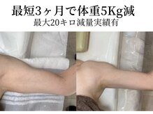 エスビューティー 三軒茶屋(S beauty)の雰囲気（産後太り・二の腕・背中・お腹から下半身痩せも最短で結果出し）