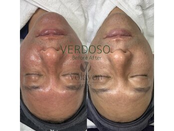 ナビ(NAVI)/ベルドソ管理