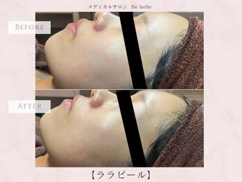 ビベル 八木店(Bebelle)/1回