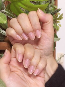 苺ネイル/スキニーネイル