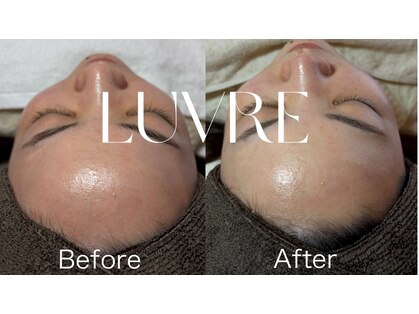 ルーヴレ(LUVRE)の写真