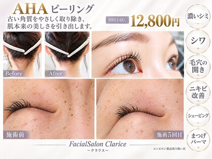 クラリス(Clarice)の写真