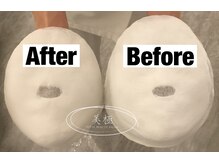 美極 トータルビューティー(美極 TOTAL BEAUTY)/恵比寿/小顔コルギ/エステ/