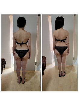 エニユイ(緑eniyui結)/Revi-Cell Body