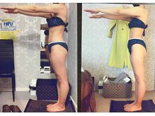 パーフェクトボディプレミアム 札幌駅前店(PERFECT BODY PREMIUM)/お客様　ビフォーアフター（8）