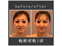 サロン ド ハーモニー美/コルギ♪左右非対称改善面長改善