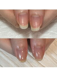 元々美爪でも地爪育成ケア