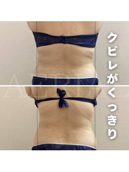 エアリアル 武雄店/脂肪冷却痩身