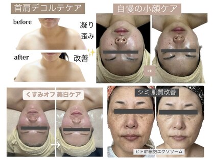ステラ(stella)の写真