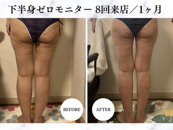 シーフェイス 横浜店(SEE FACE)/下半身ゼロダイエットモニター様