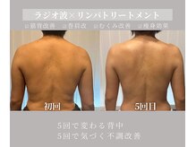 サロン ルポ(Repos)の雰囲気（ラジオ波×リンパケアで不調改善。背中美人へ。）