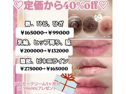 ミラージュ(mirage)の写真