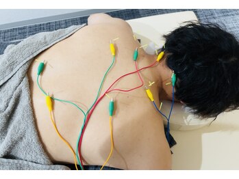 ザワ鍼灸接骨院(zawa鍼灸接骨院)/鍼灸施術