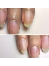 ネイルコテージ 新宿南口店(Nail cottage)/甘皮ケア