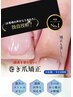【巻き爪ケア】2本／丁寧な施術で美しく整える