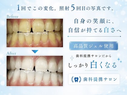 セルフダック 宮城角田店(SELFDUCK)の写真