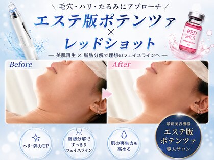 エミット(emit.)の写真