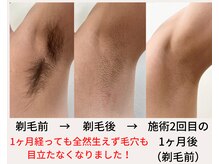 バニッシュ 川口店(VANISH)/太い毛も！