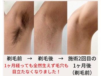 バニッシュ 川口店(VANISH)/太い毛も！