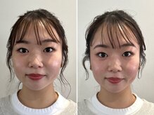 ビー バランス(Be.BALANCE)/【小顔矯正】