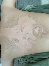 スリジエ ボーテ(cerisierBEAUTE)/お薬によるお腹の黒ずみにも◎