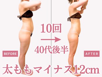 べモーレ 上本町 谷町九丁目(Bemolle)/40代痩身10回ビフォーアフター☆