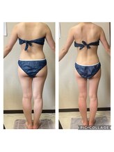 美ボディラボ(美Body Labo)/最新マシン導入