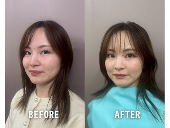 レディゴ./ビフォーアフター