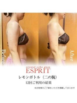 エスプリ 銀座店/レモンボトル×シェイプスリム