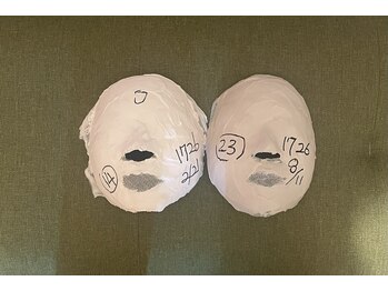 シャインビューティー(ShineBeauty)/石膏パックビフォーアフター写真