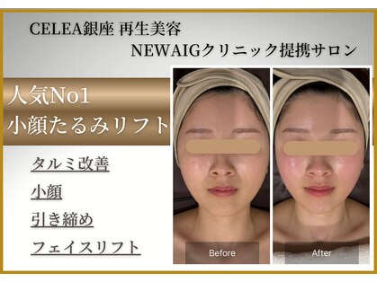 セレア(CELEA)の写真