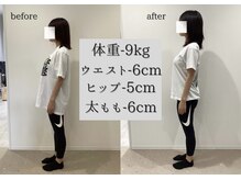 チューン(Tune)の雰囲気（【ビフォーアフター】姿勢改善/ダイエット/肩こり/腰痛改善/美脚）