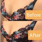 エステティック レイビス 池袋店(RAYVIS)