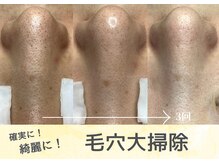 カンパニュラ(campanula)