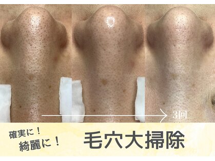 カンパニュラ(campanula)の写真