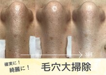 カンパニュラ(campanula)