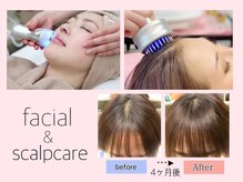 ピーチ グリーン(Peach green)