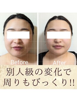 スウ(suu.)/Before-After【30代】12 回